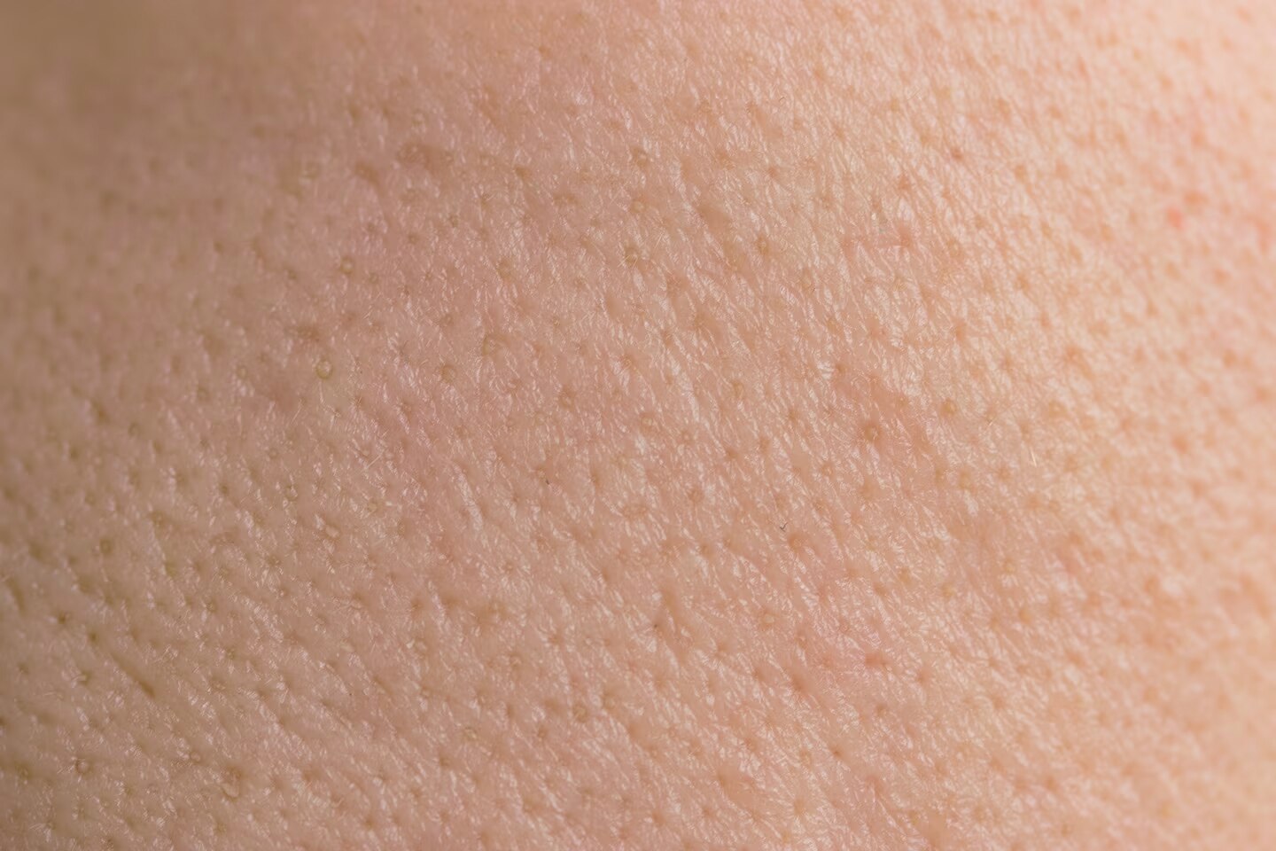 Très gros plan sur une peau humaine, montrant en détail la texture des pores.