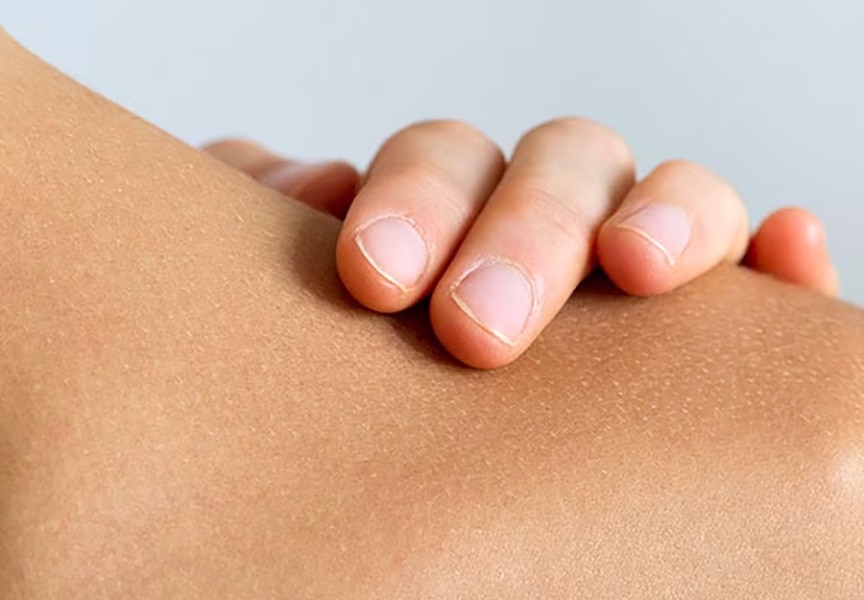 Gros plan sur une main posée sur un bras, montrant la texture de la peau avec la chair de poule.