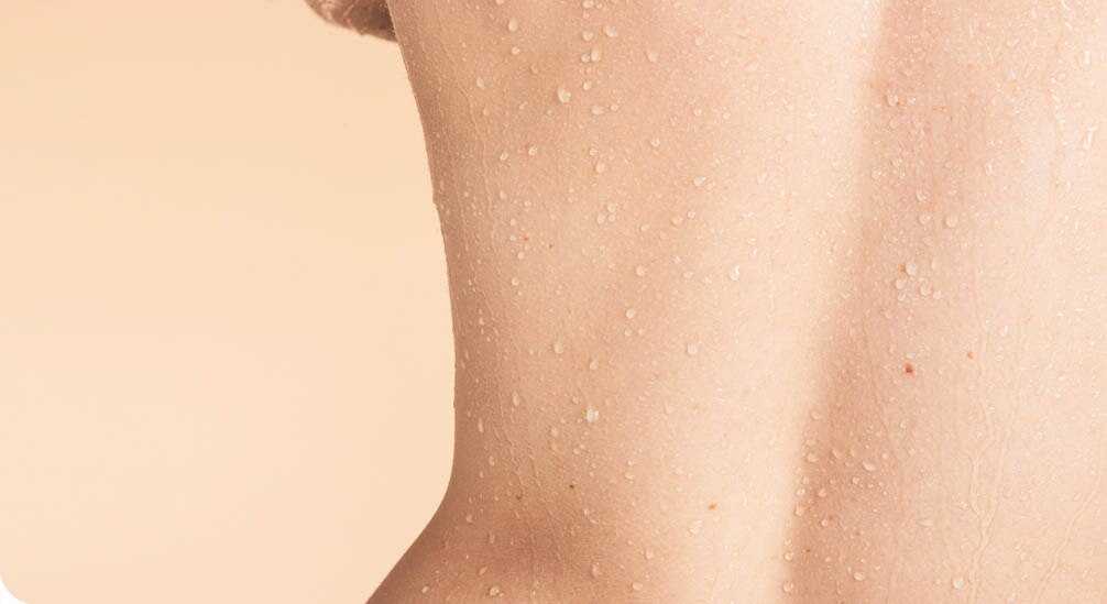 Gros plan sur le dos d'une personne à la peau claire, couvert de fines gouttelettes d'eau qui soulignent sa texture.